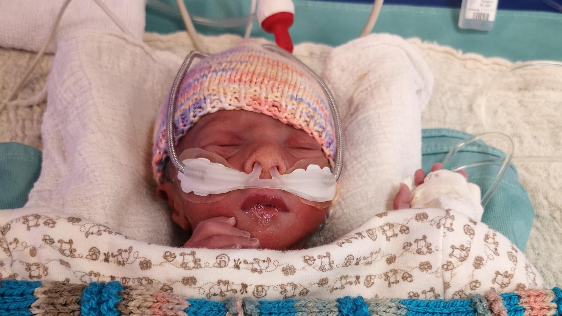 Kinderkrankenschwester rettet Neugeborene in Eritrea