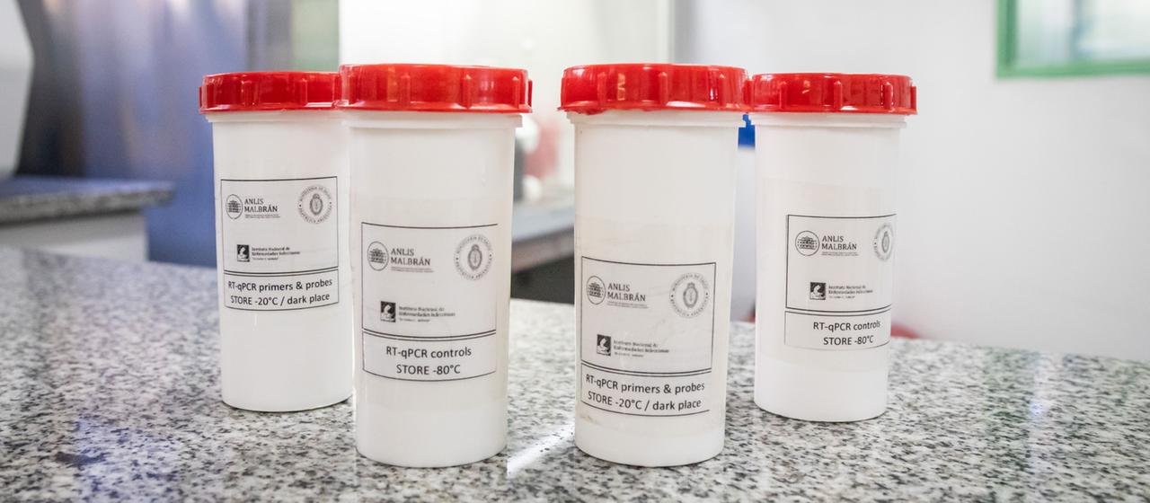 Reagenzien des Hantavirus-Typ Andesvirus stehen in einem Labor.