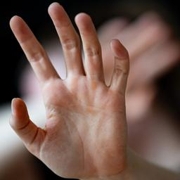 Eine Frau hält ihre Hände schützend vor sich.