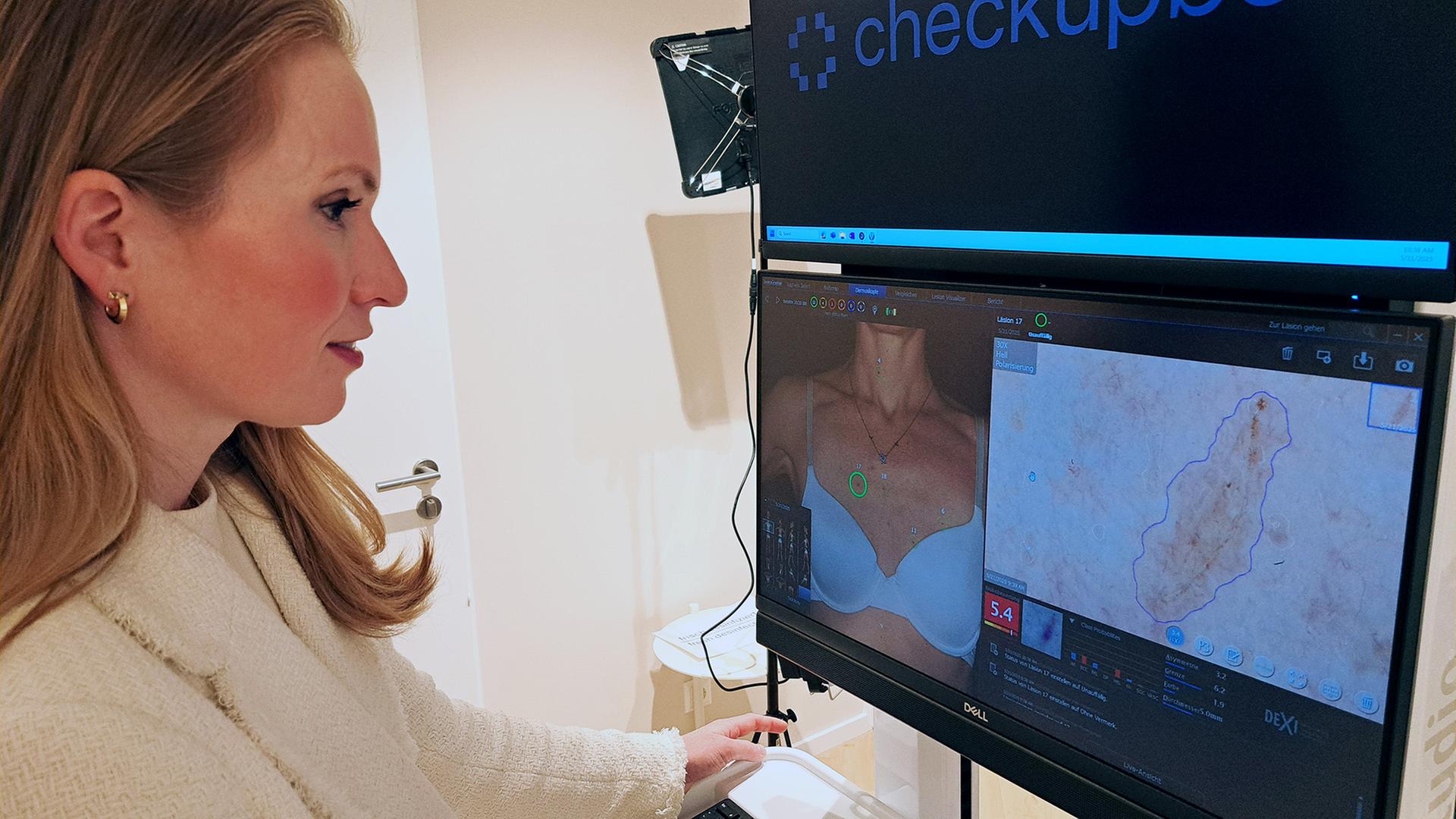 Neue Wege in der Vorsorge: Hautkrebs-Check mit KI und Ferndiagnose