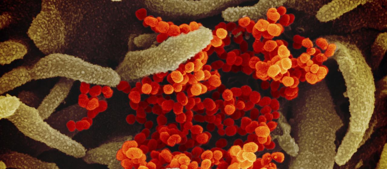 Eine elektronenmikroskopische Aufnahme des "U.S. National Institute of Health" zeigt das neuartige Coronavirus (orange), das aus der Oberfläche von im Labor kultivierten Zellen (grau) austritt.