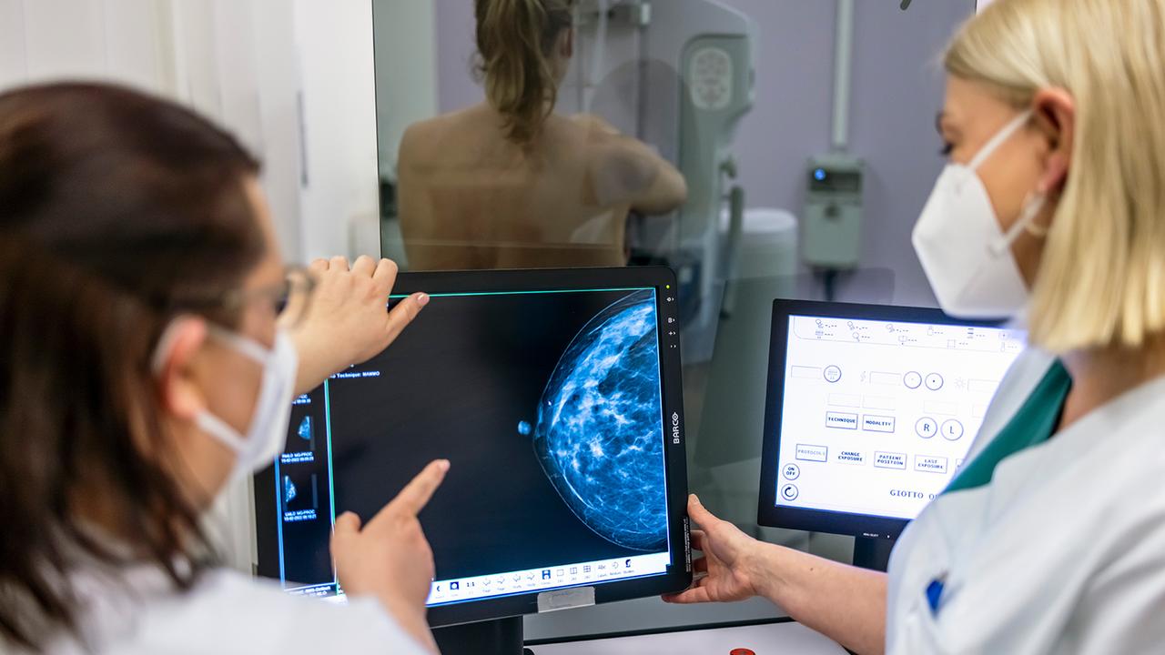 Mammography Screening May Start at 45