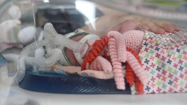 Ein Frühchen liegt in einem Brutkasten an einem Atemschlauch angeschlossen.