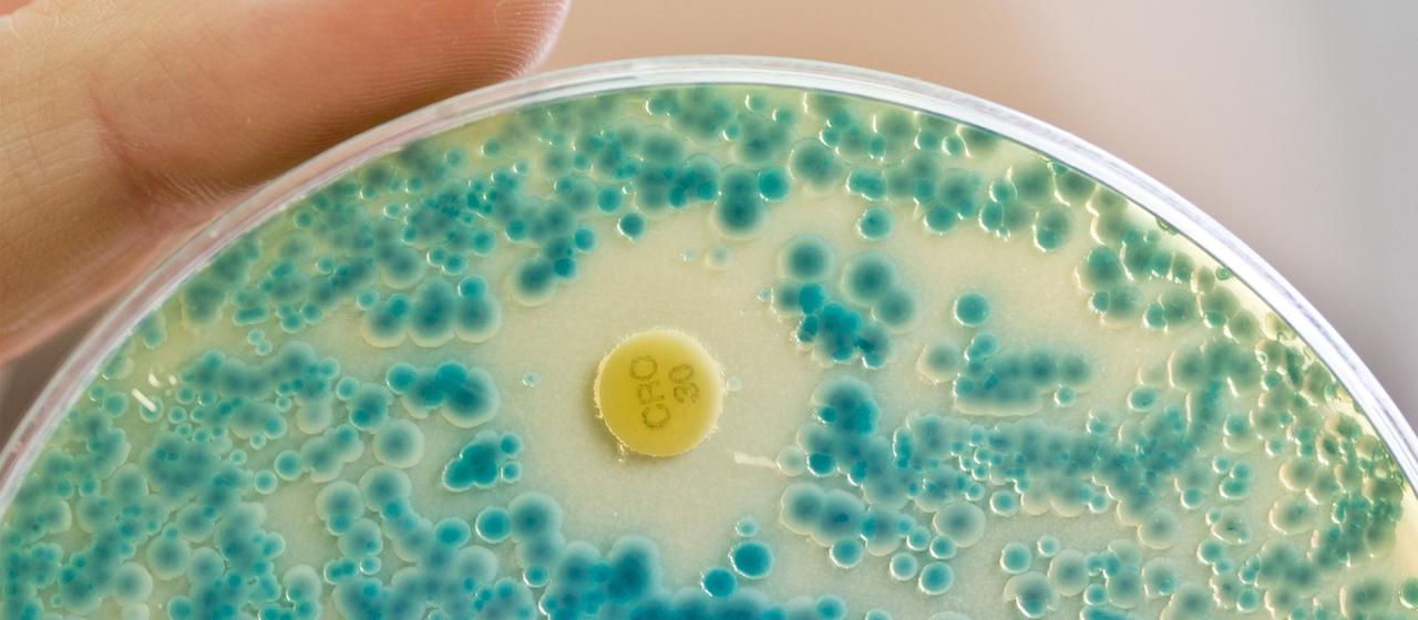 Multiresistente Keime in Petrischale