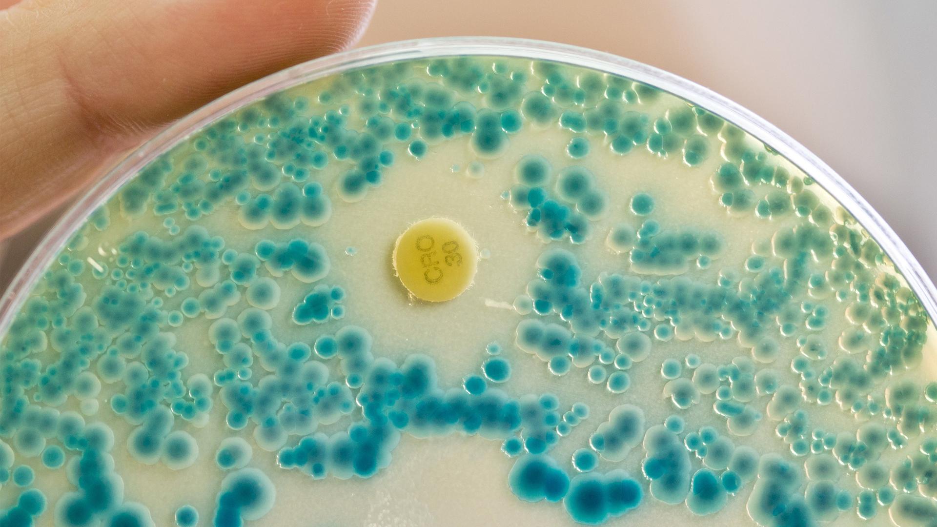 Multiresistente Keime in Petrischale | dpa