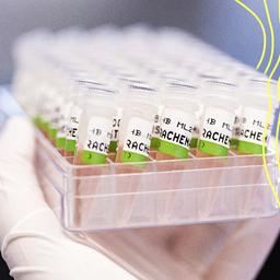 Eine Mitarbeiterin am Landesgesundheitsamt Niedersachsen hält eine Box mit Rachenabstrichen für PCR-Tests.