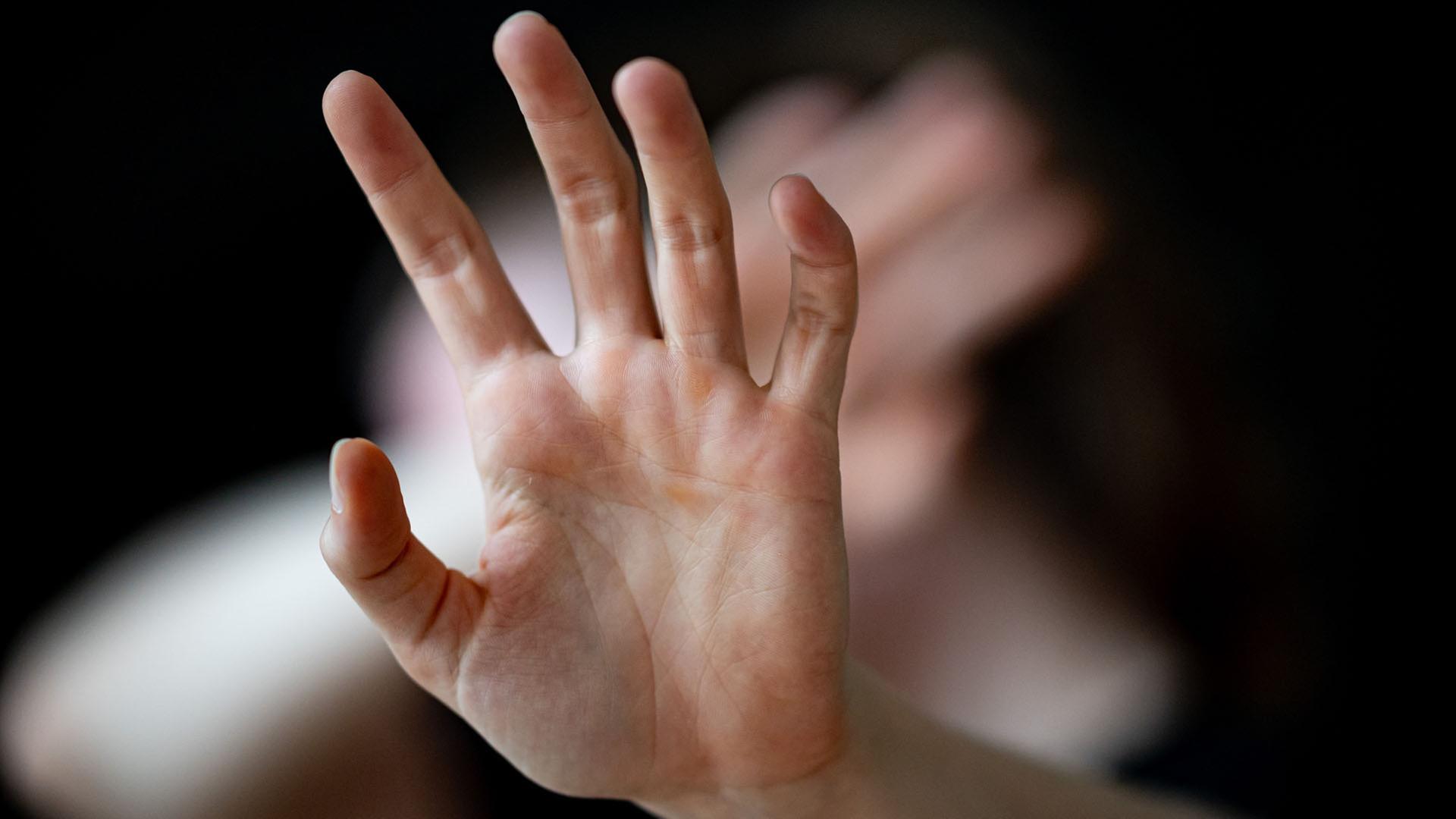 Eine Frau hält ihre Hände vor das Gesicht.  | dpa