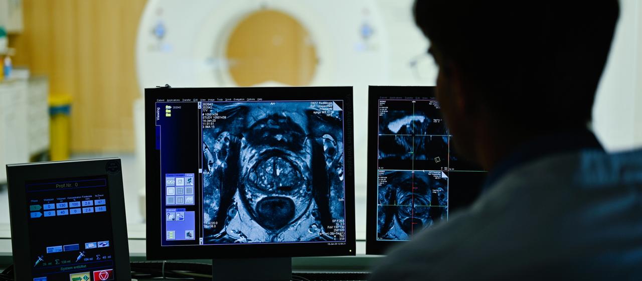 Ein Mitarbeiter betrachtet in einem Kontrollraum des Deutschen Krebsforschungszentrum (DKFZ) auf einem Monitor das Querschnittsbild einer Prostata.