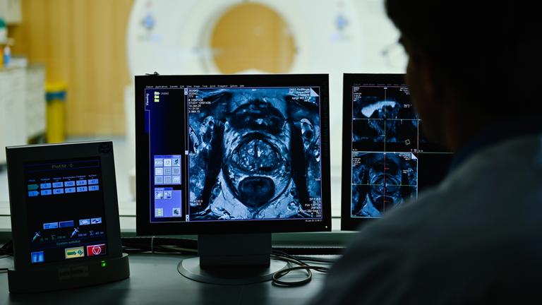 Ein Mitarbeiter betrachtet in einem Kontrollraum des Deutschen Krebsforschungszentrum (DKFZ) auf einem Monitor das Querschnittsbild einer Prostata.