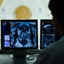 Ein Mitarbeiter betrachtet in einem Kontrollraum des Deutschen Krebsforschungszentrum (DKFZ) auf einem Monitor das Querschnittsbild einer Prostata.