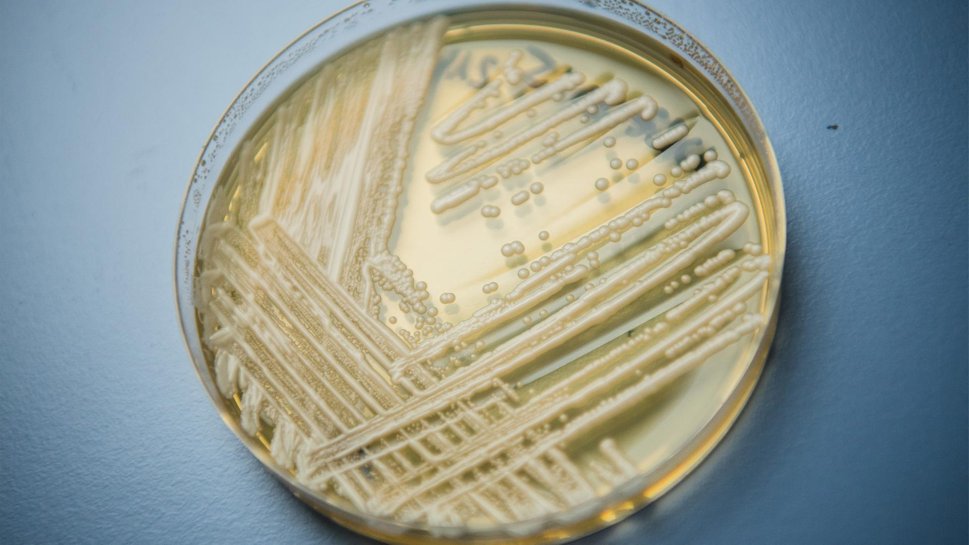 Der Hefepilz Candidozyma auris in einer Petrischale. | dpa