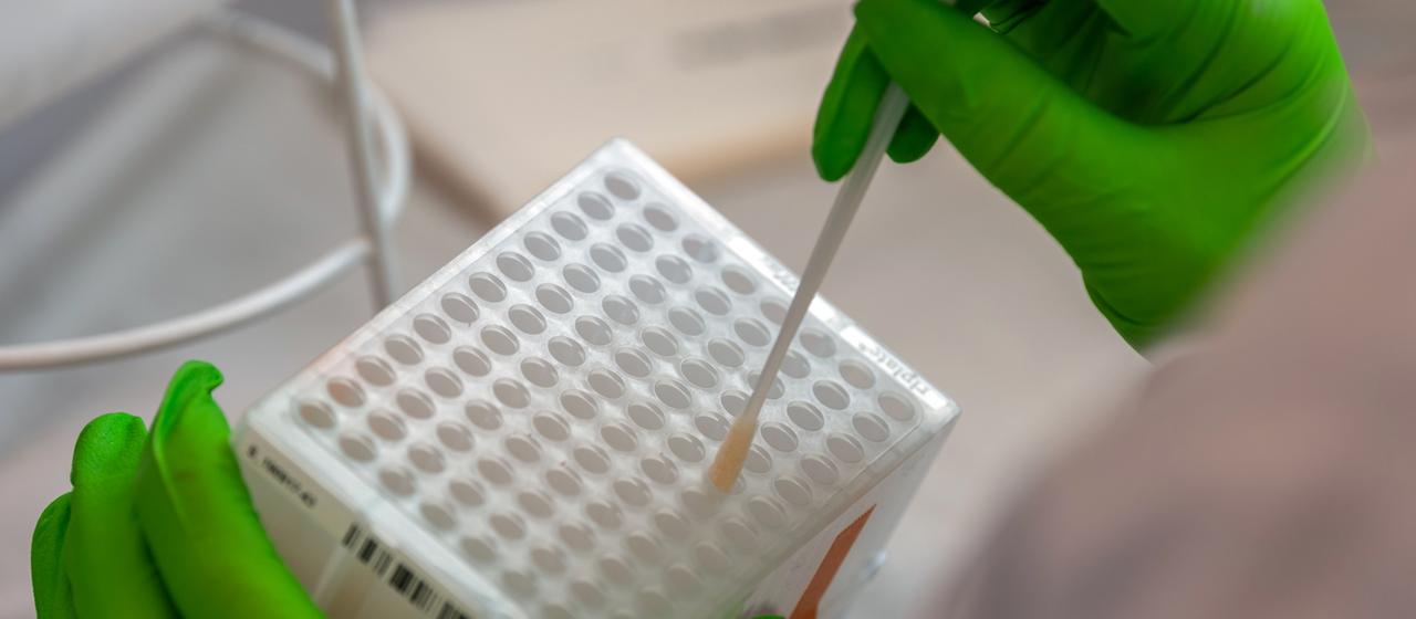 Eine Mitarbeiterin arbeitet an der Einsortierung der medizinischen Wattestäbchen mit Zellen der Wangenschleimhaut für den Typisierungsprozess der DNA. | dpa Eine Mitarbeiterin arbeitet an der Einsortierung der medizinischen Wattestäbchen mit Zellen der Wangenschleimhaut für den Typisierungsprozess der DNA.