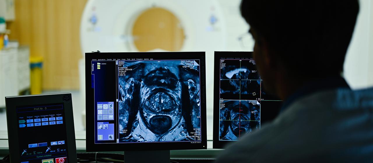 Wie Gentests vor Krebs schützen können