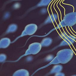 Sperma unter einem Mikroskop in Großaufnahme.