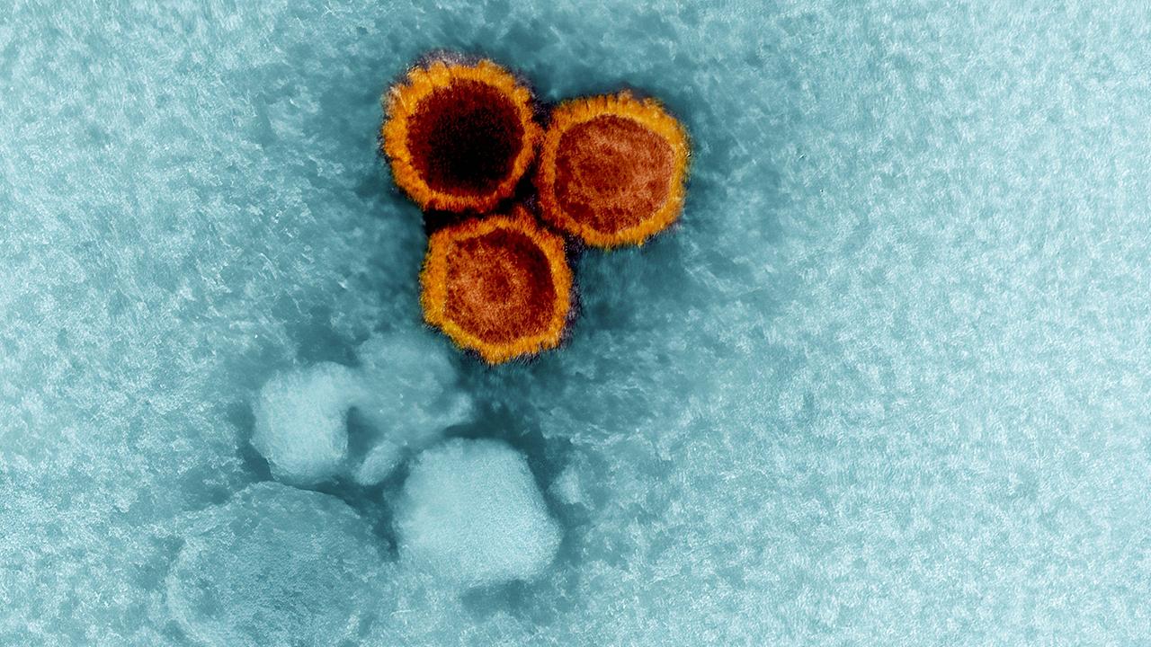 Studie: Wie ein Virus Multiple Sklerose mitauslösen kann