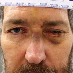 Häftling Gunter E. aus der JVA Gablingen