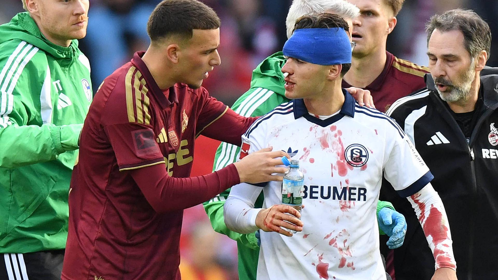 Schalke erkämpft Remis: Blutiger Zusammenprall bei Nullnummer in Köln