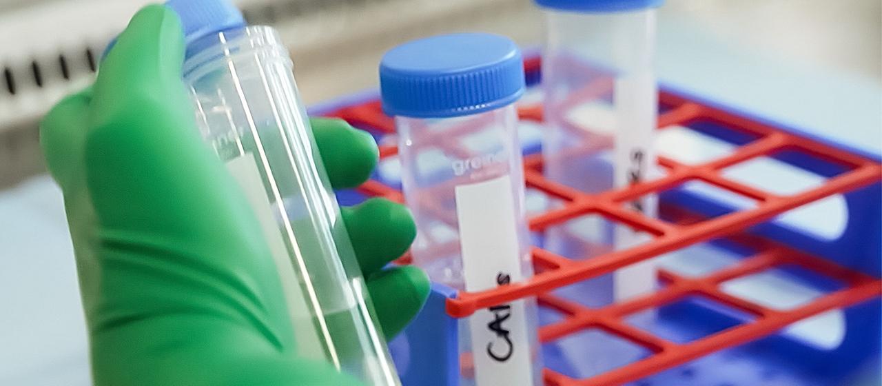 Eine Person hält ein Reagenzglas in der Hand.