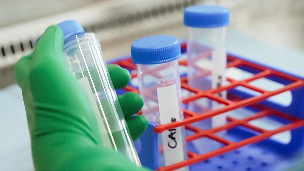 Wie Zelltherapien bezahlbar werden könnten