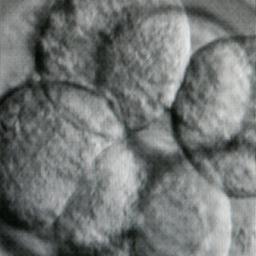 Zellteilung (acht Zellen)