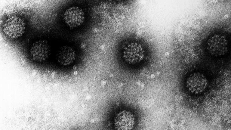 Elektronenmikroskopische Aufnahme mehrerer Humaner Papillomviren (HPV)