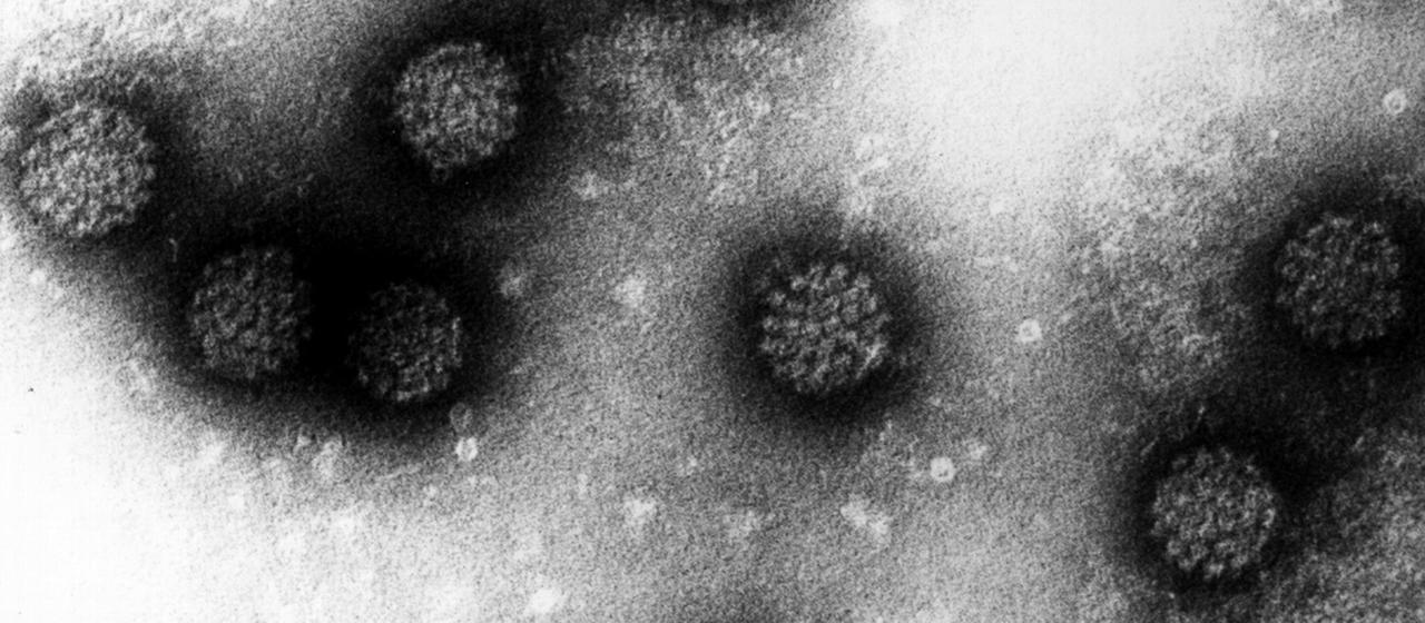Elektronenmikroskopische Aufnahme mehrerer Humaner Papillomviren (HPV) | dpa Elektronenmikroskopische Aufnahme mehrerer Humaner Papillomviren (HPV)