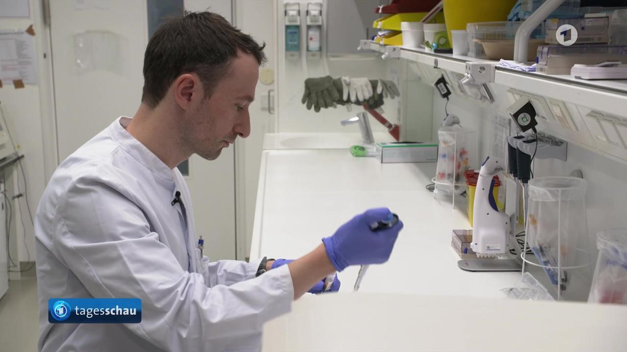 Forscher entwickeln Bluttest zur Behandlung von Schlaganfällen