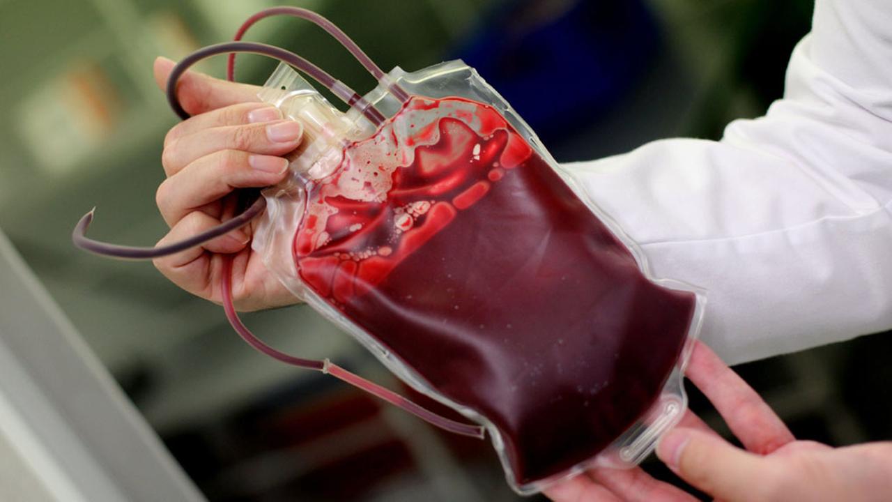 Gibt es bald knstliches Blut aus dem Labor? | tagesschau.de Gibt es bald knstliches Blut aus dem Labor? | tagesschau.de