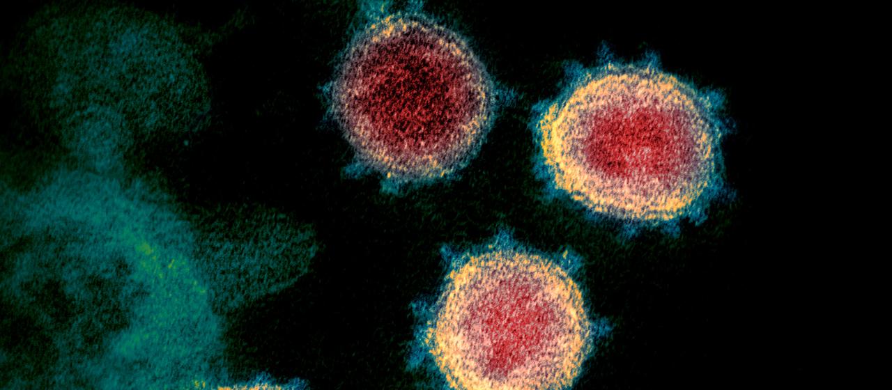 Neue Corona-Varianten: Wie gefhrlich sind die Mutationen? | tagesschau.de