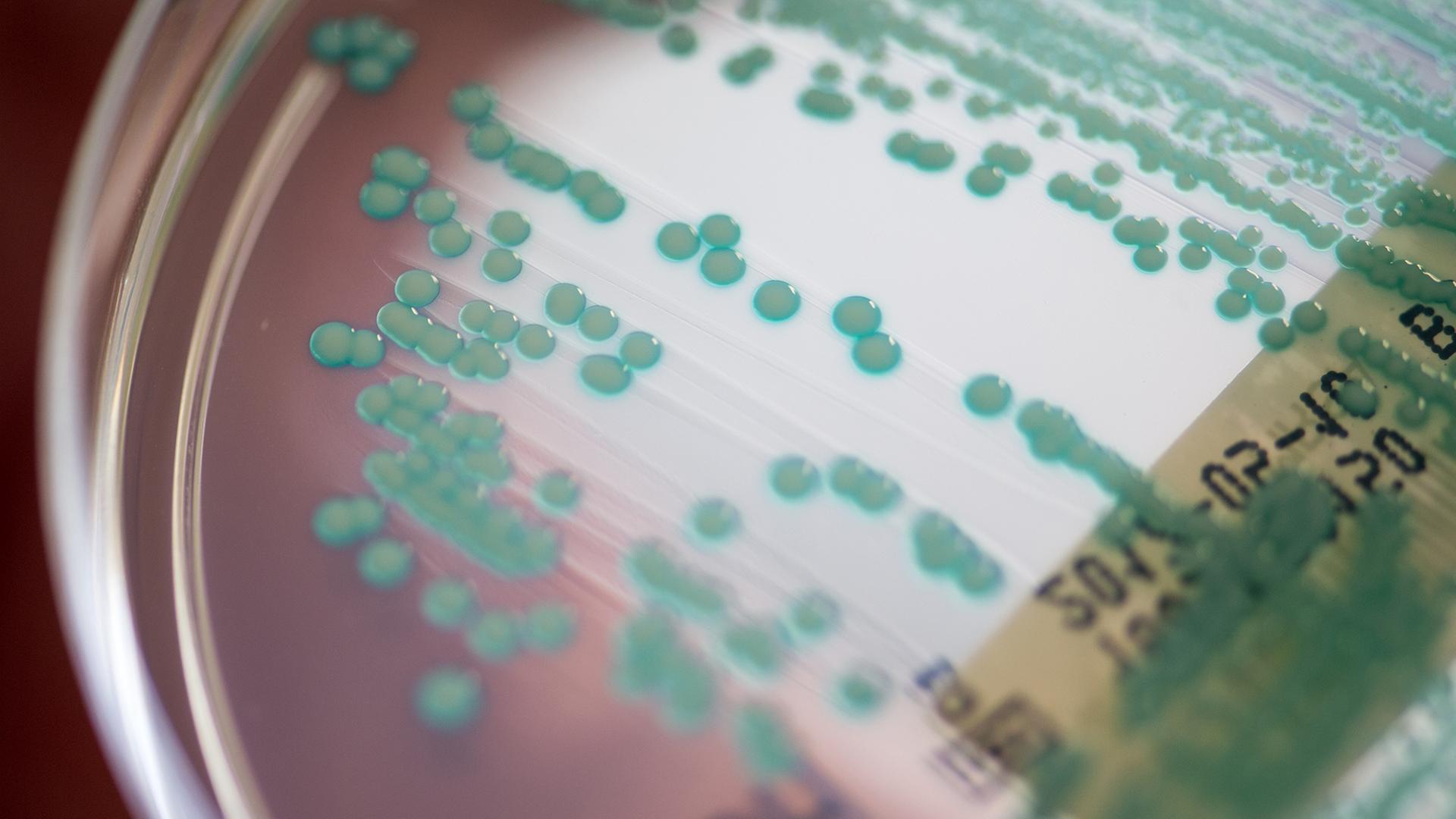 Globale Gesundheit: Resistente Keime werden zur Herausforderung