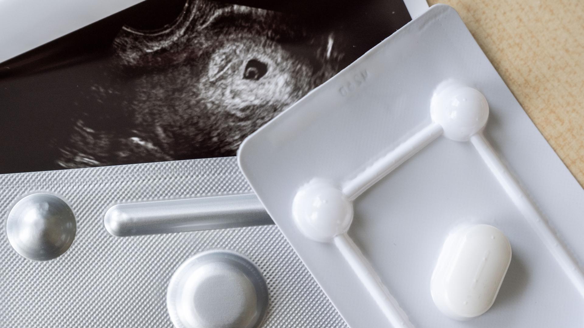 Medikamente zum Schwangerschaftsabbruch liegen neben einem Ultraschallbild.