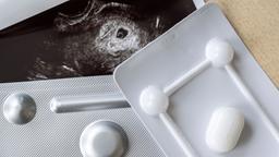 Medikamente zum Schwangerschaftsabbruch liegen neben einem Ultraschallbild.