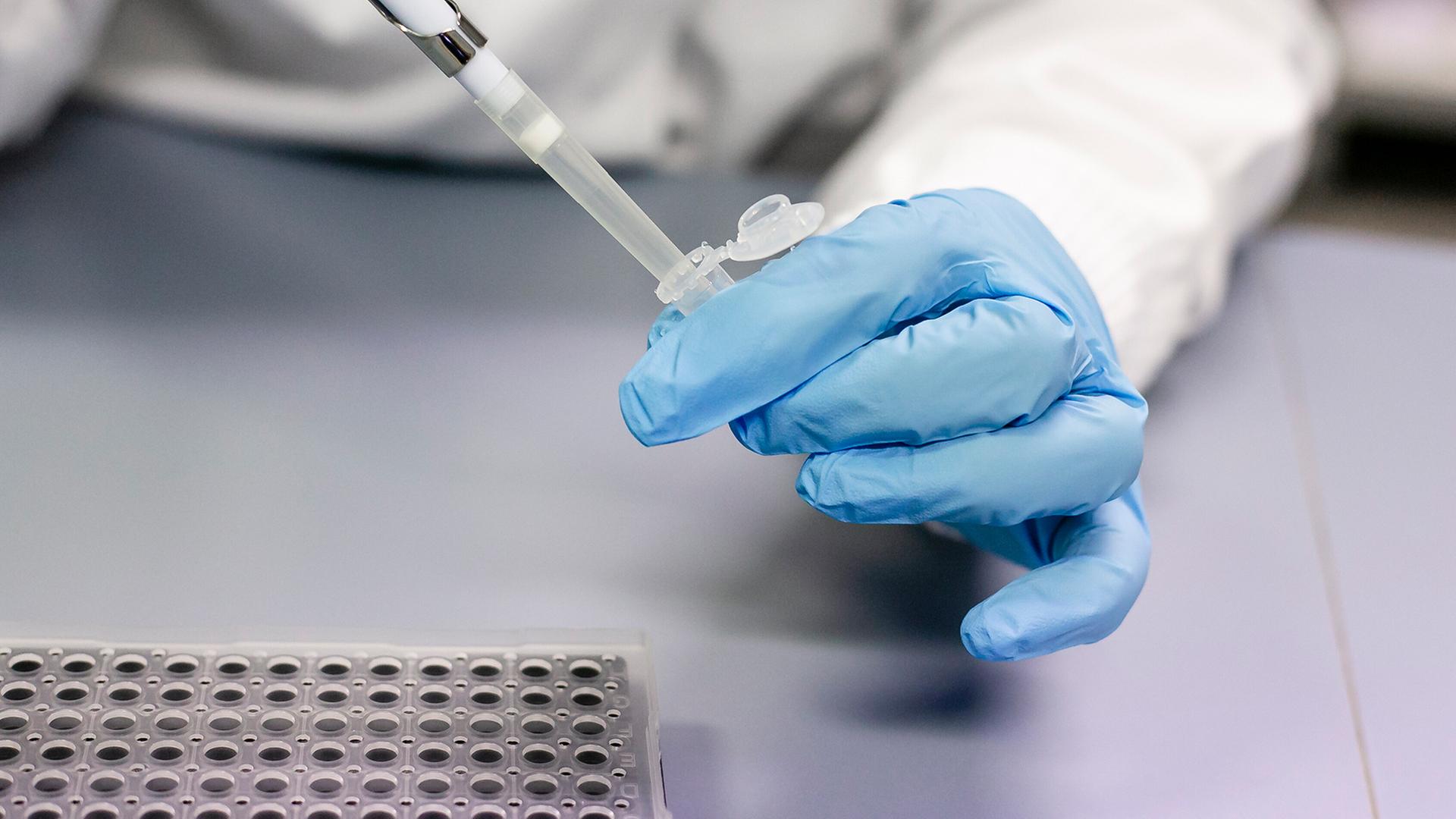 Flüssigkeit wird mit einer Pipette in ein Behältnis gefüllt.