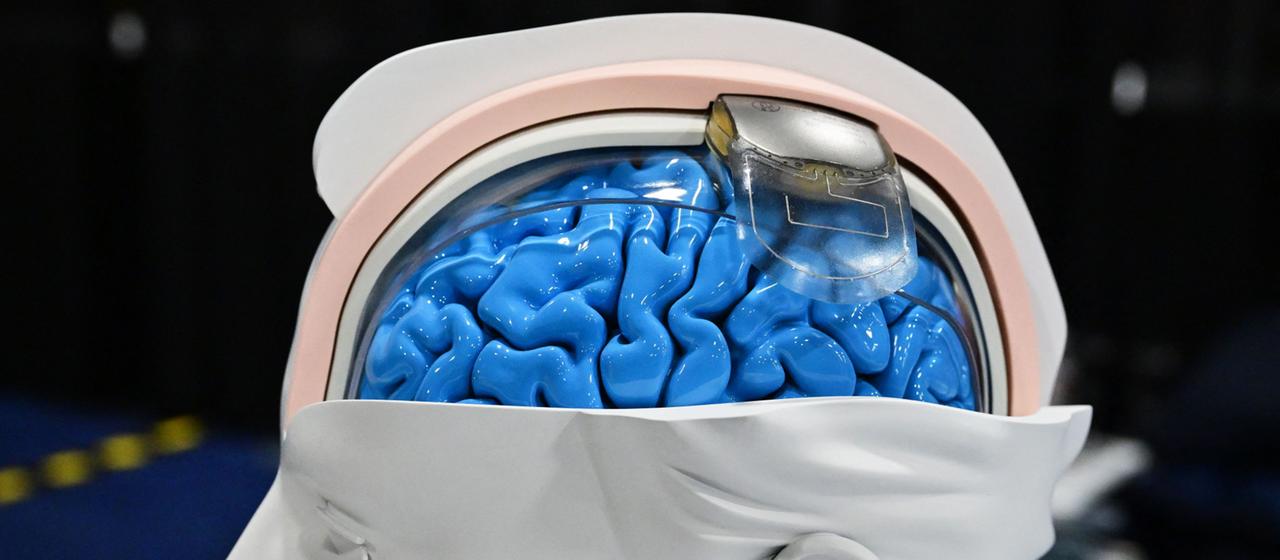Model eines Gehirnimplantats