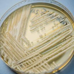 Pilz in einer Petrischale. 