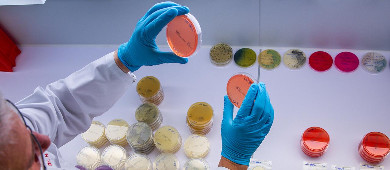 Ein Laborarbeiter untersucht Trägerplatten mit dem Bakterien