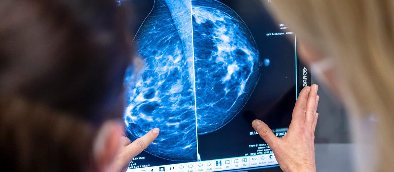 Medizinisches Personal untersucht mit einer Mammografie die Brust einer Frau auf Brustkrebs