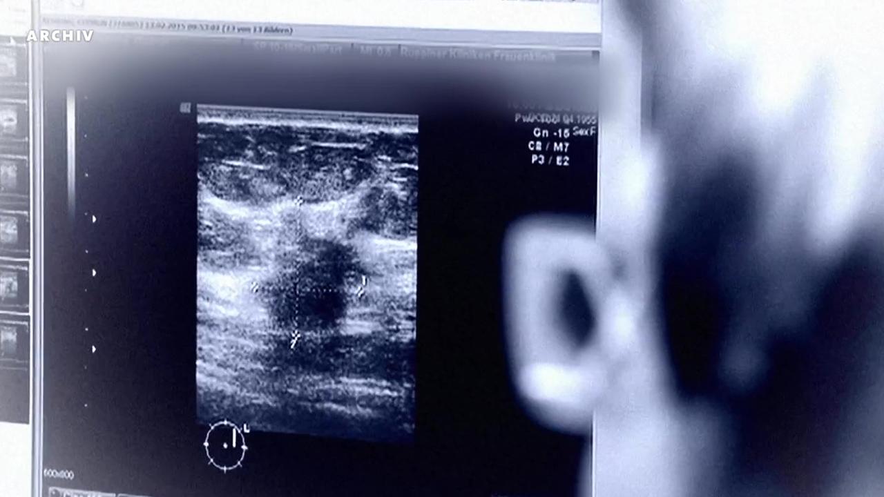 Positive Bilanz des Mammografie-Screenings zur Krebsfrüherkennung