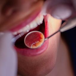 Ein Zahnarzt schaut sich mit einem Spiegel die Zähne einer Patientin an.