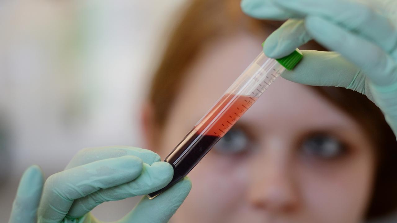 Abgeordnete fordern Prüfung von Bluttests bei Schwangeren