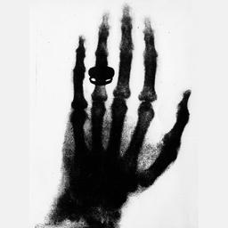 Röntgenaufnahme einer Hand - aufgenommen von Wilhelm Conrad Röntgen