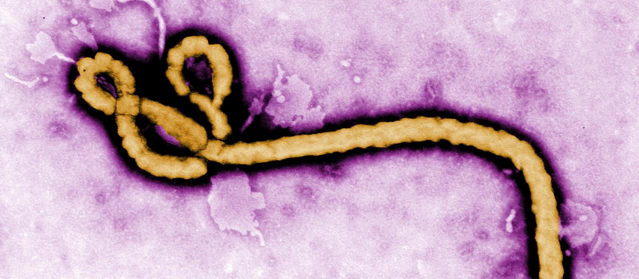 Ebola-Virus