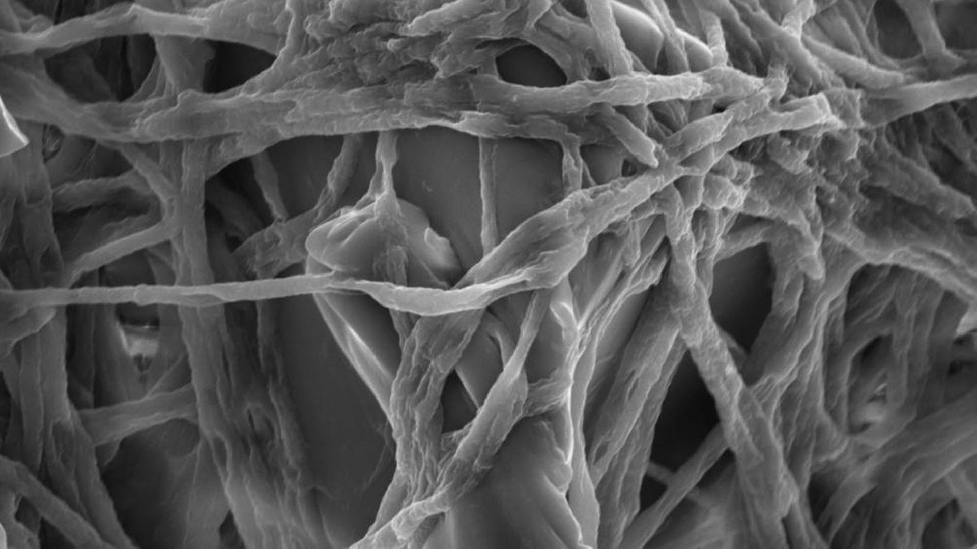 Die elektronenmikroskopische Aufnahme zeigt Pilzmyzelien von Fusarium, die einen Kunststoffpartikel besiedeln. | Sabreen Samuel Ibrahim Dawoud