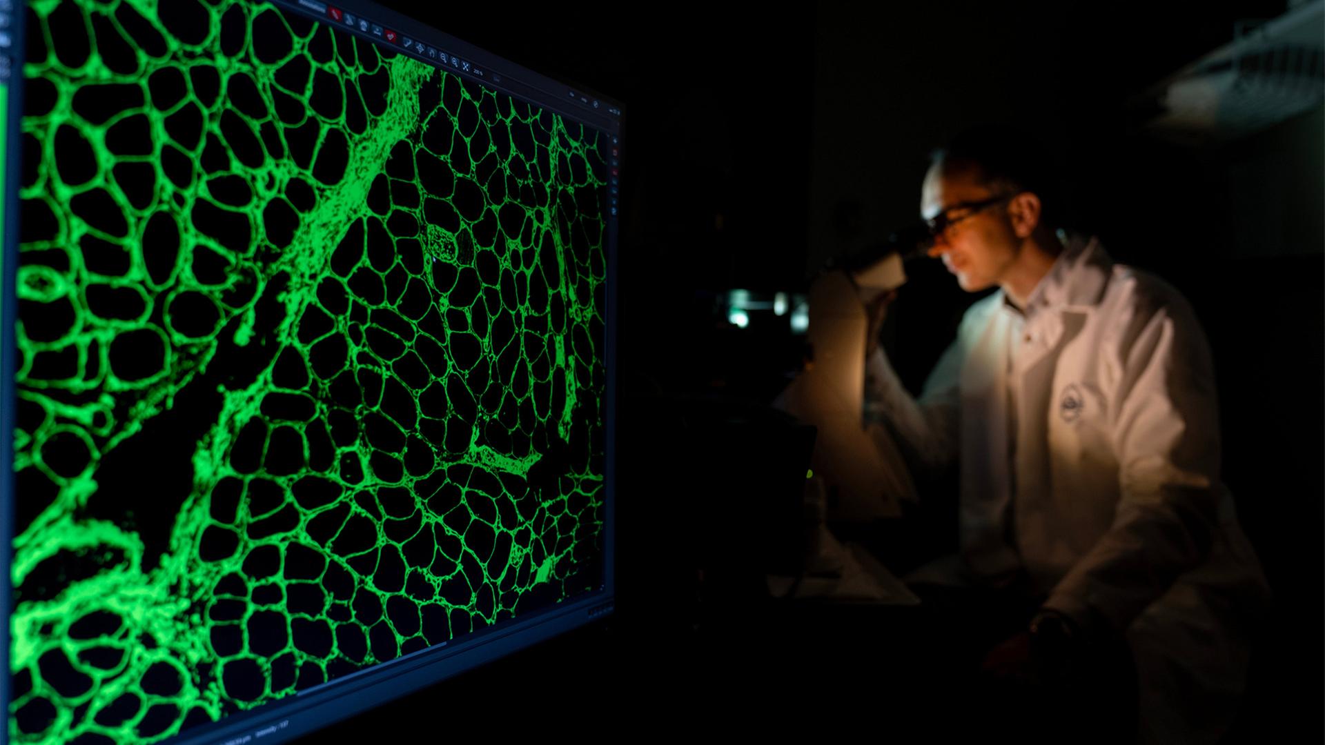 Ein klinischer Mitarbeiter untersucht Zellen aus einer Muskelbiopsie. | AP