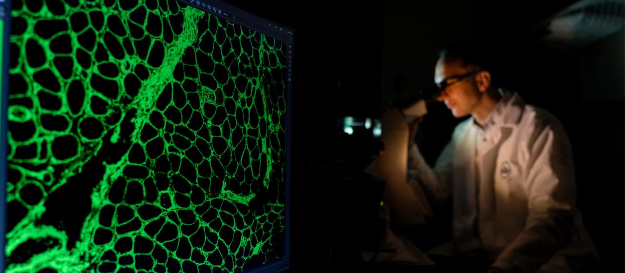 Ein klinischer Mitarbeiter untersucht Zellen aus einer Muskelbiopsie.